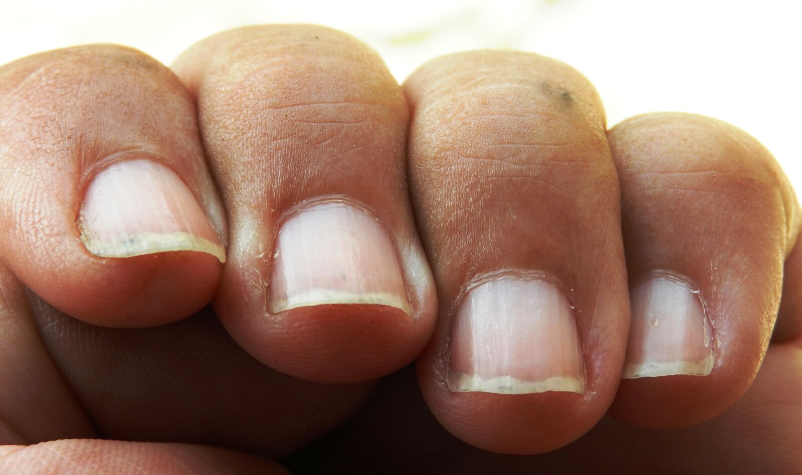 Nikon Coolpix B700 sample photo. Fingers, nail, hand photography