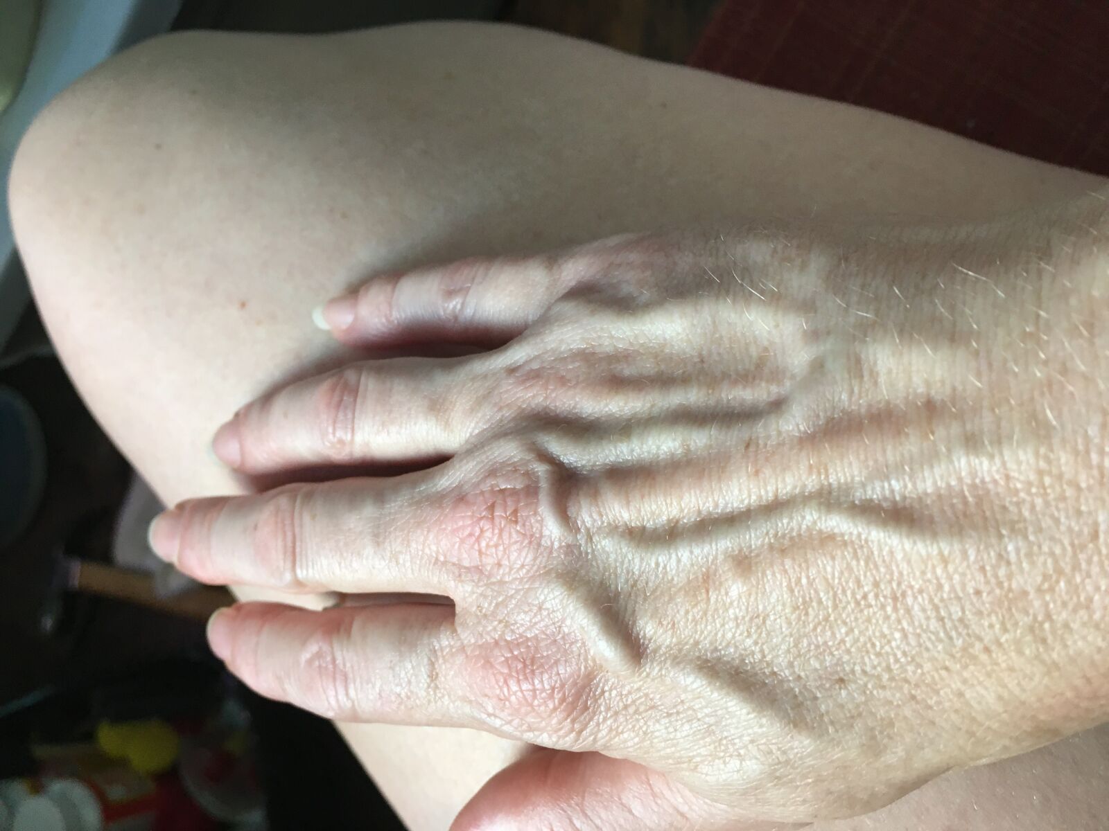 iPhone 6s back camera 4.15mm f/2.2 sample photo. Venous, blood, pressure photography