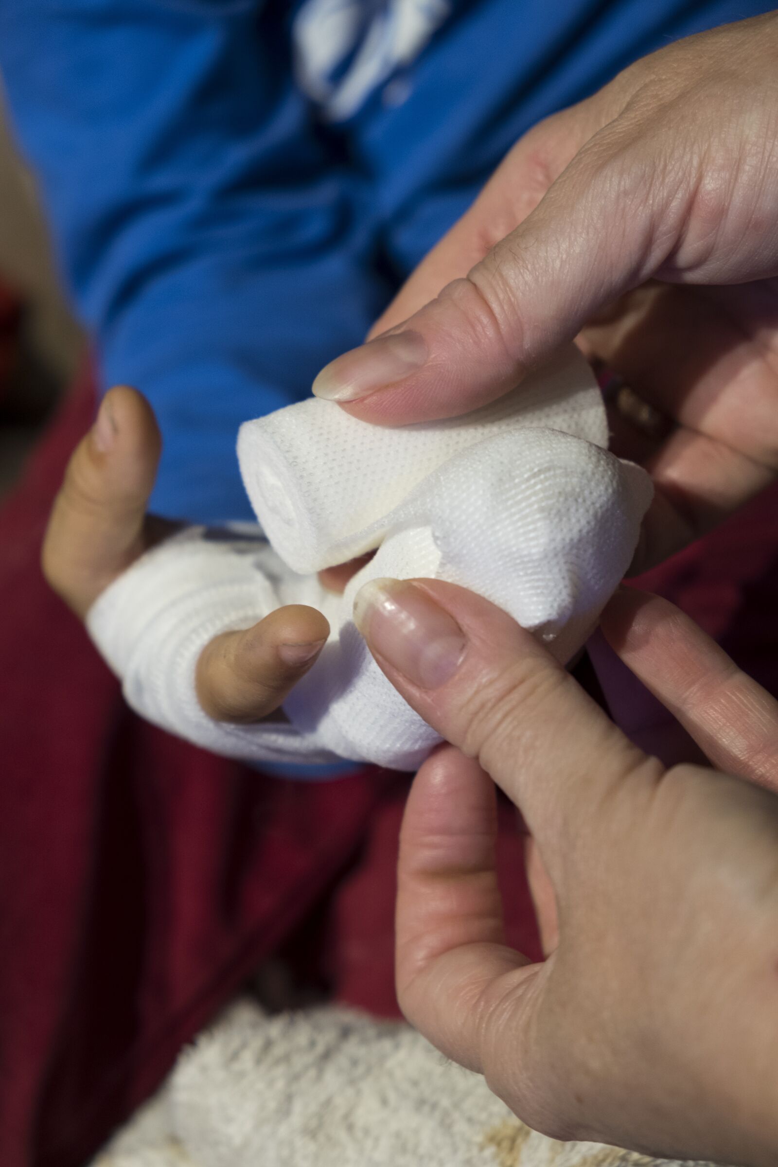 Fujifilm XF 18-55mm F2.8-4 R LM OIS sample photo. Child, boy, injury photography