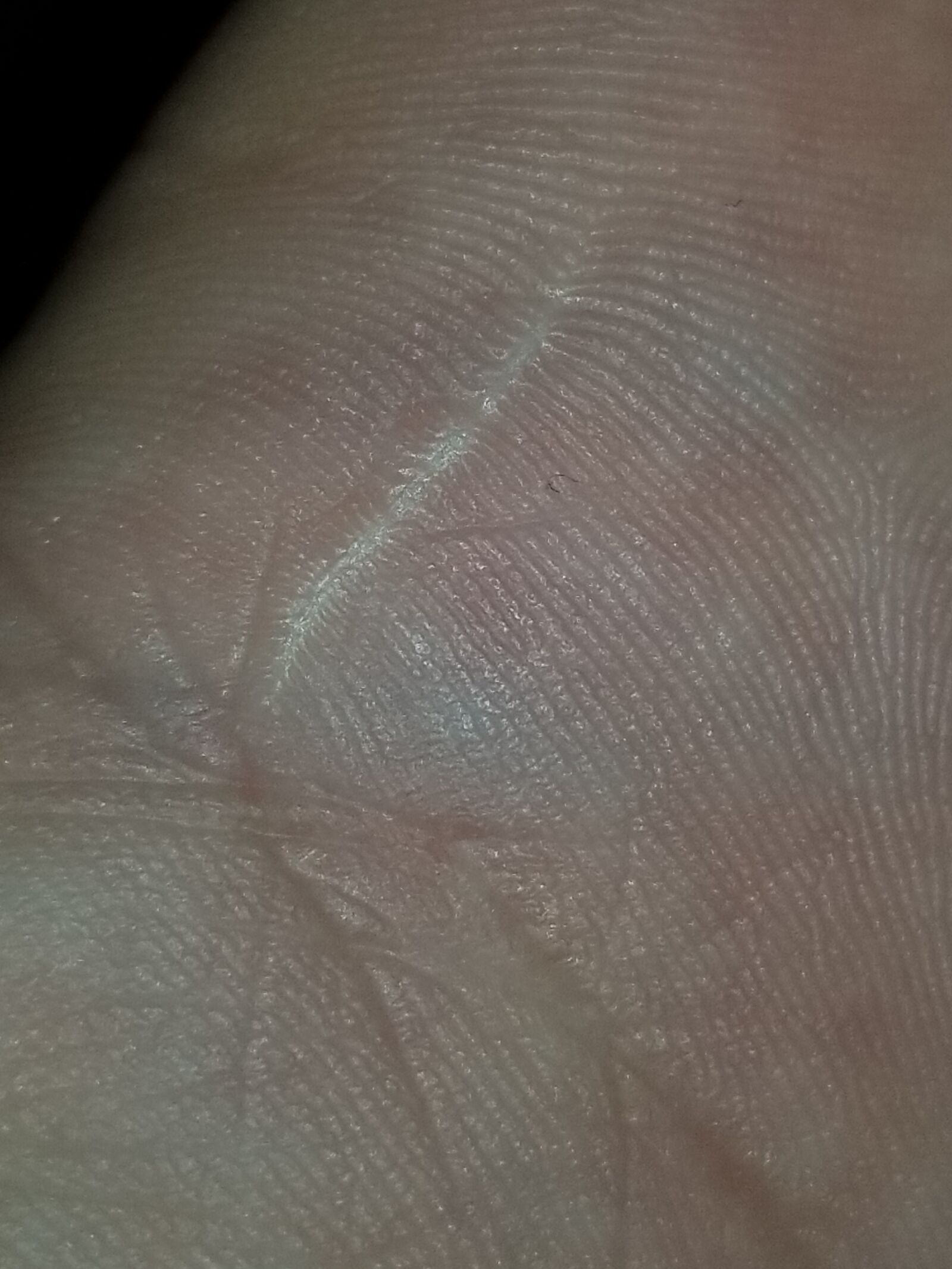 Samsung Galaxy S8+ sample photo. Hand, scar, scar, scars photography