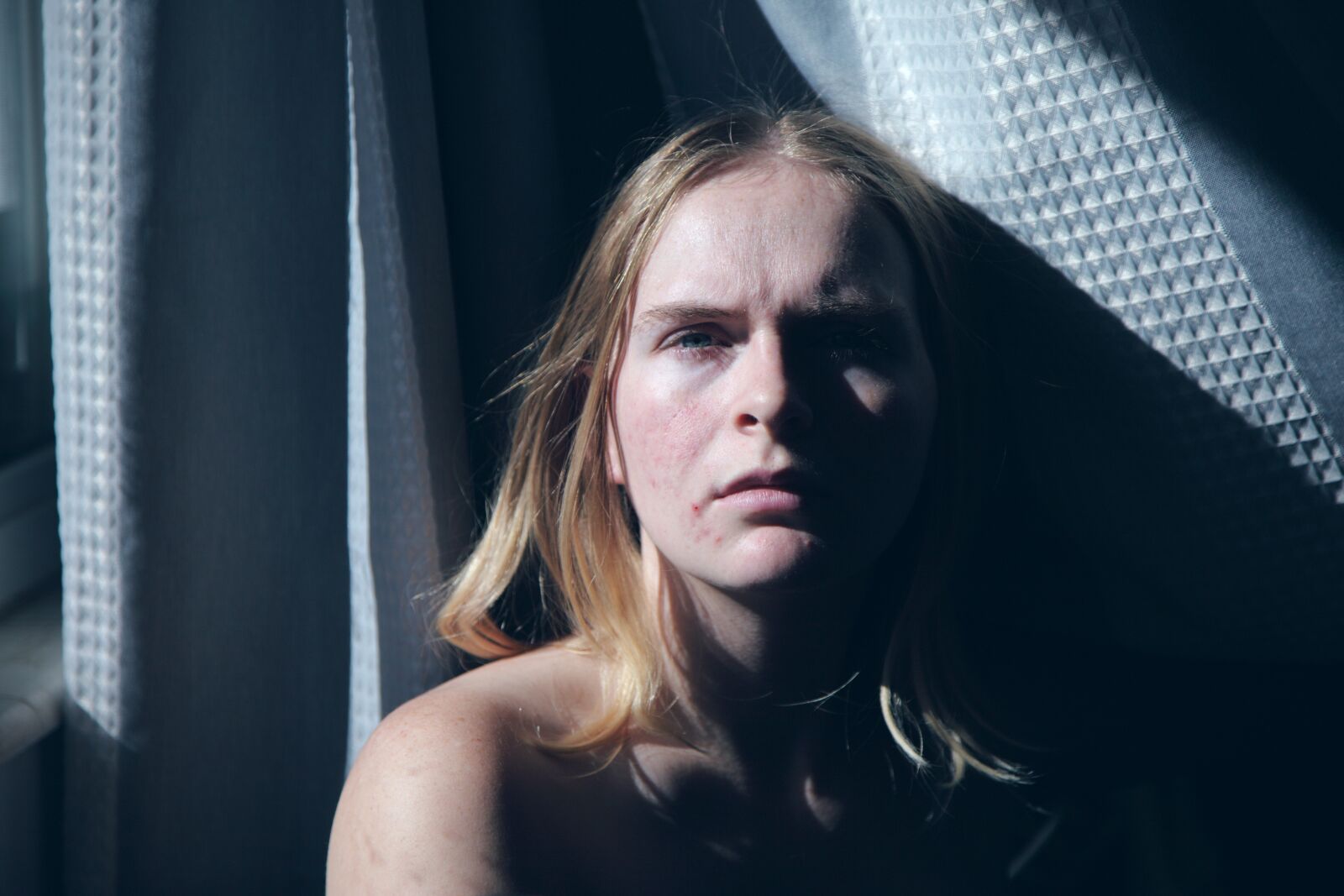 Canon EOS 5D Mark II sample photo. Daylight savings, acne, counseling photography