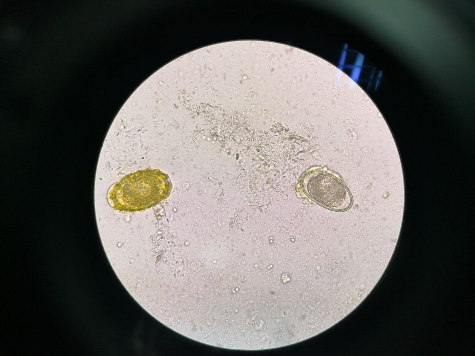 HUAWEI JKM-LX2 sample photo. Eggs, microscopy, parasite photography
