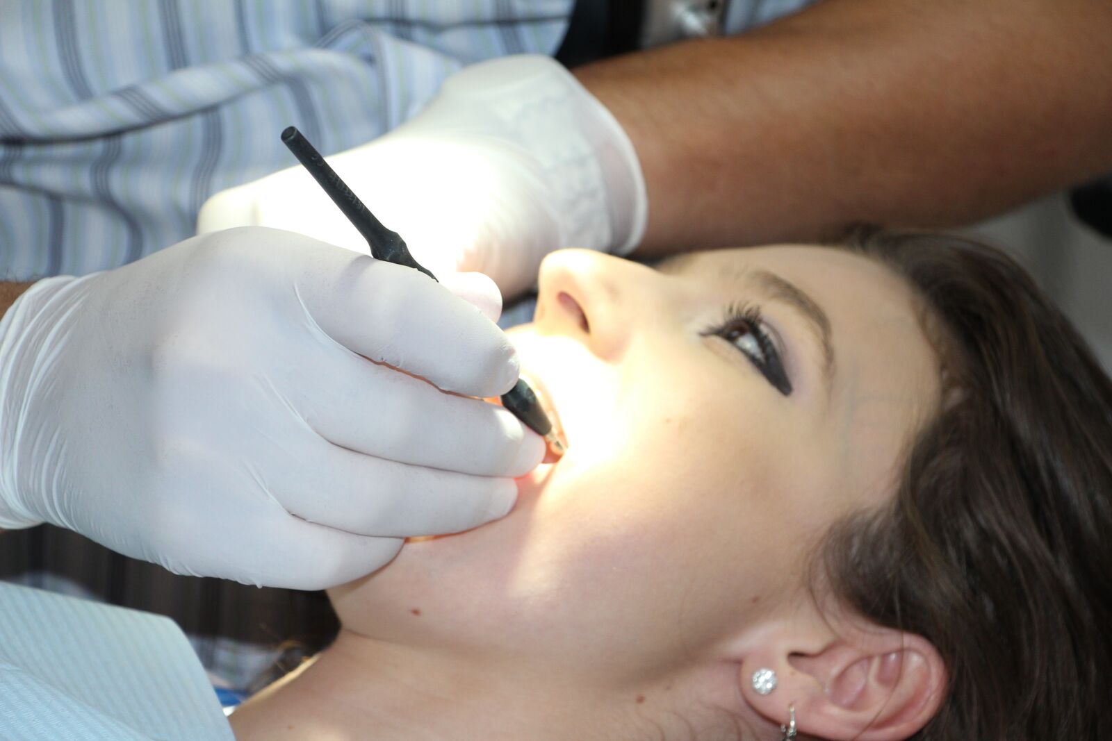 Canon EOS 650D (EOS Rebel T4i / EOS Kiss X6i) sample photo. Zahnreinigung, dental repairs, treat photography