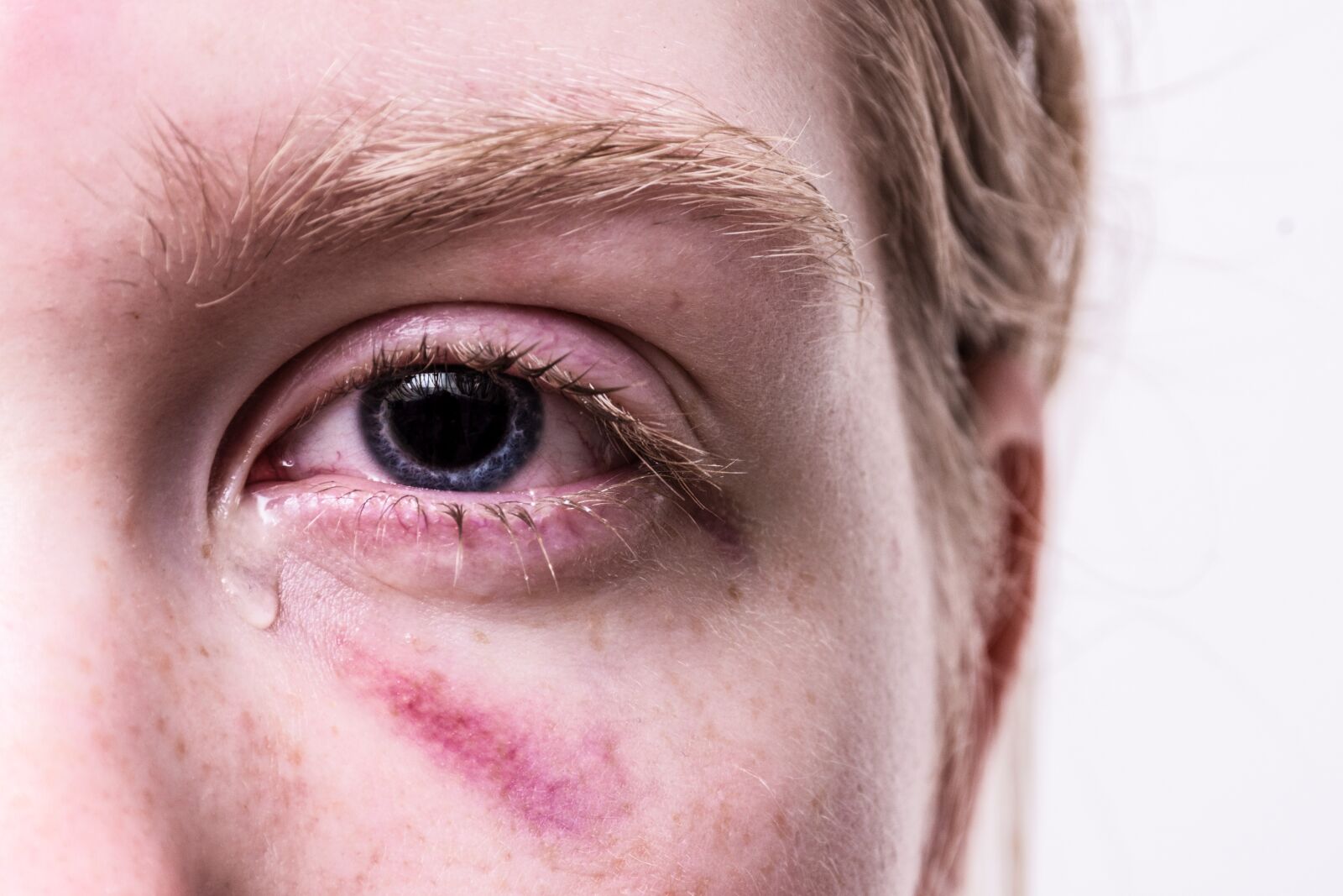 Nikon D7200 sample photo. Trauma, injured, violent photography