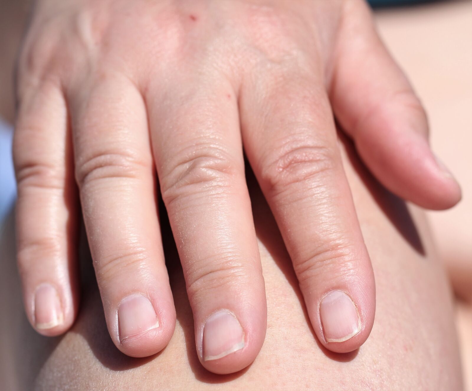Canon EF 100mm F2.8L Macro IS USM sample photo. Hand, finger, skin photography