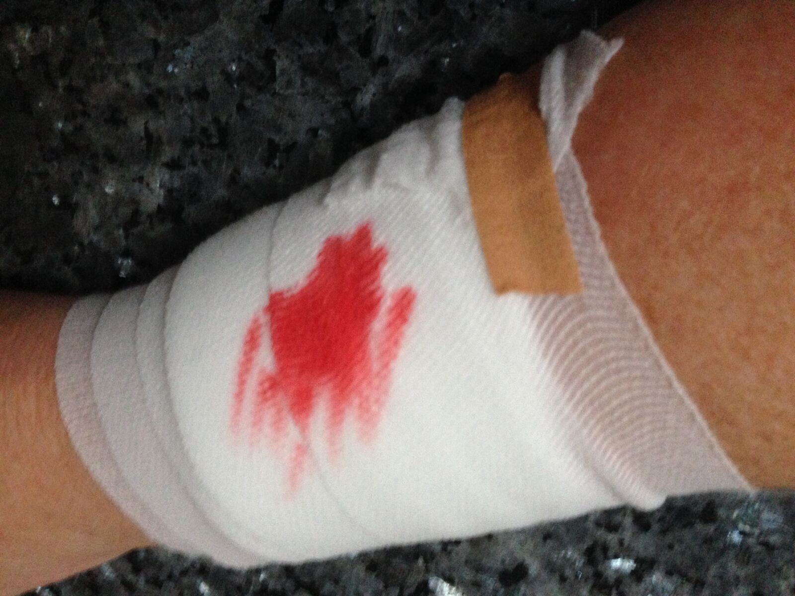 iPhone 5 back camera 4.12mm f/2.4 sample photo. Snelverband, plaster, blood photography