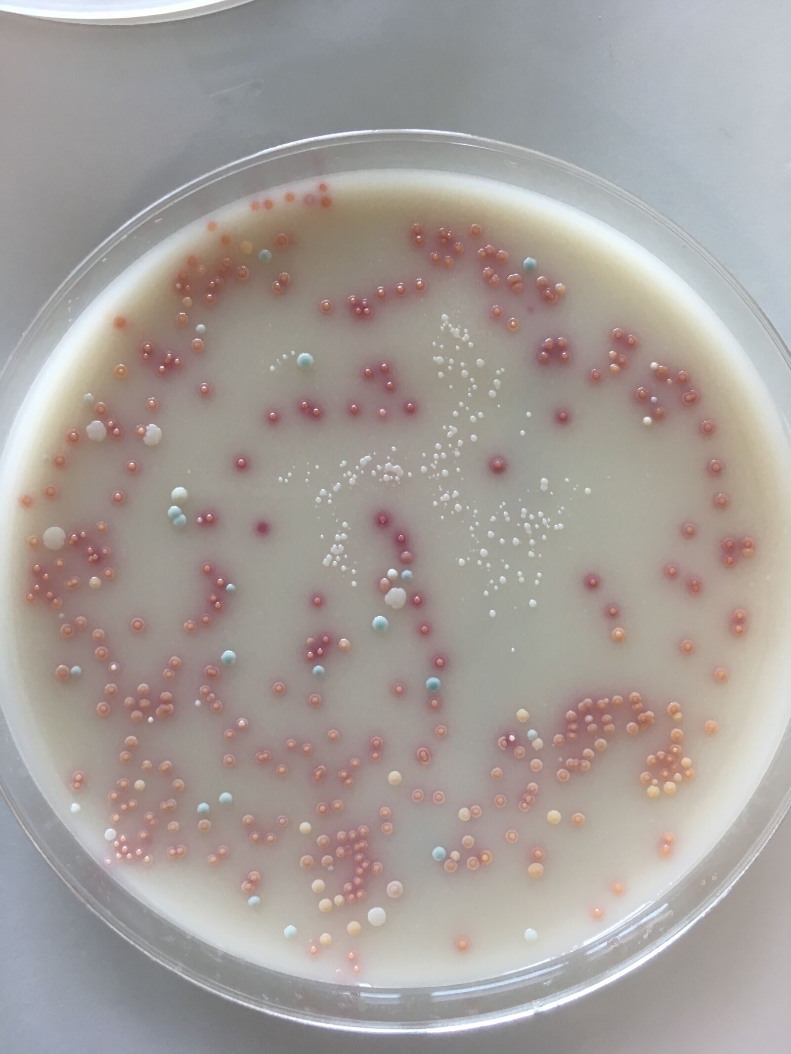 iPhone SE back camera 4.15mm f/2.2 sample photo. Bacteria, staphylococcus, germs photography