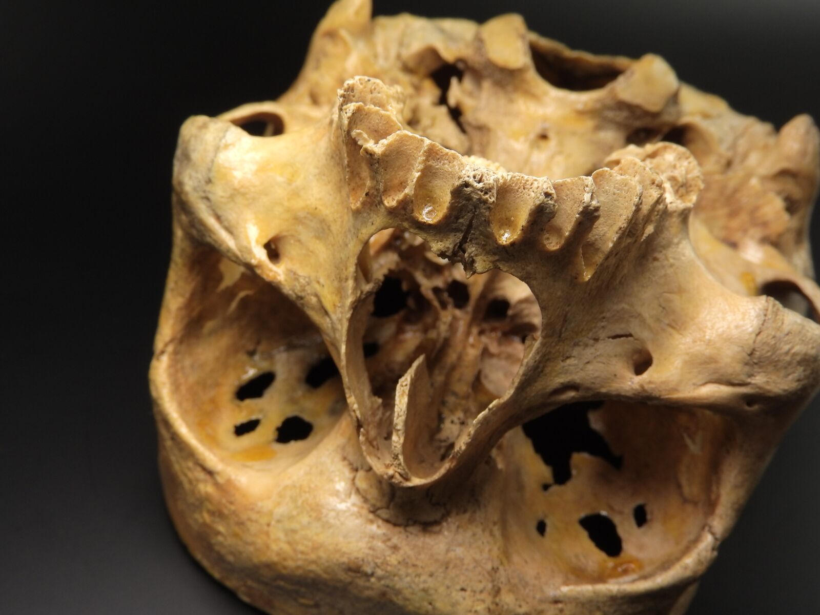 Nikon Coolpix P610 sample photo. Skull, human skull, exhibit photography
