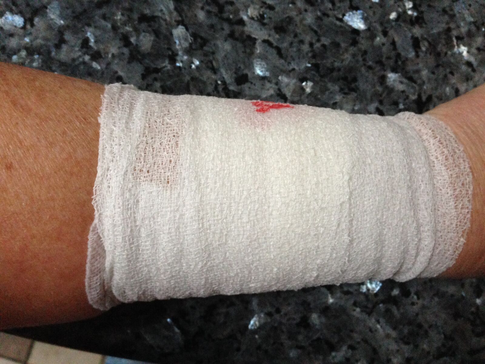 iPhone 5 back camera 4.12mm f/2.4 sample photo. Bandage, snelverband, cohesive bandage photography