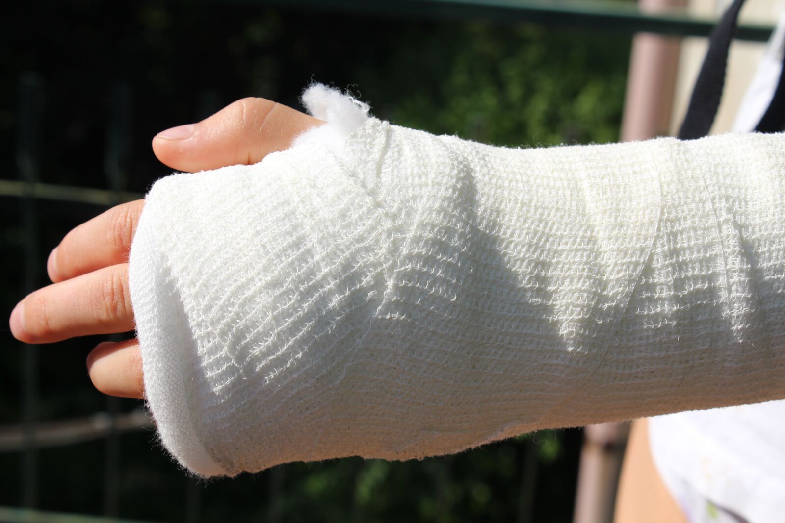 Canon EOS 1200D (EOS Rebel T5 / EOS Kiss X70 / EOS Hi) sample photo. Injury, orthopedics, chalk photography
