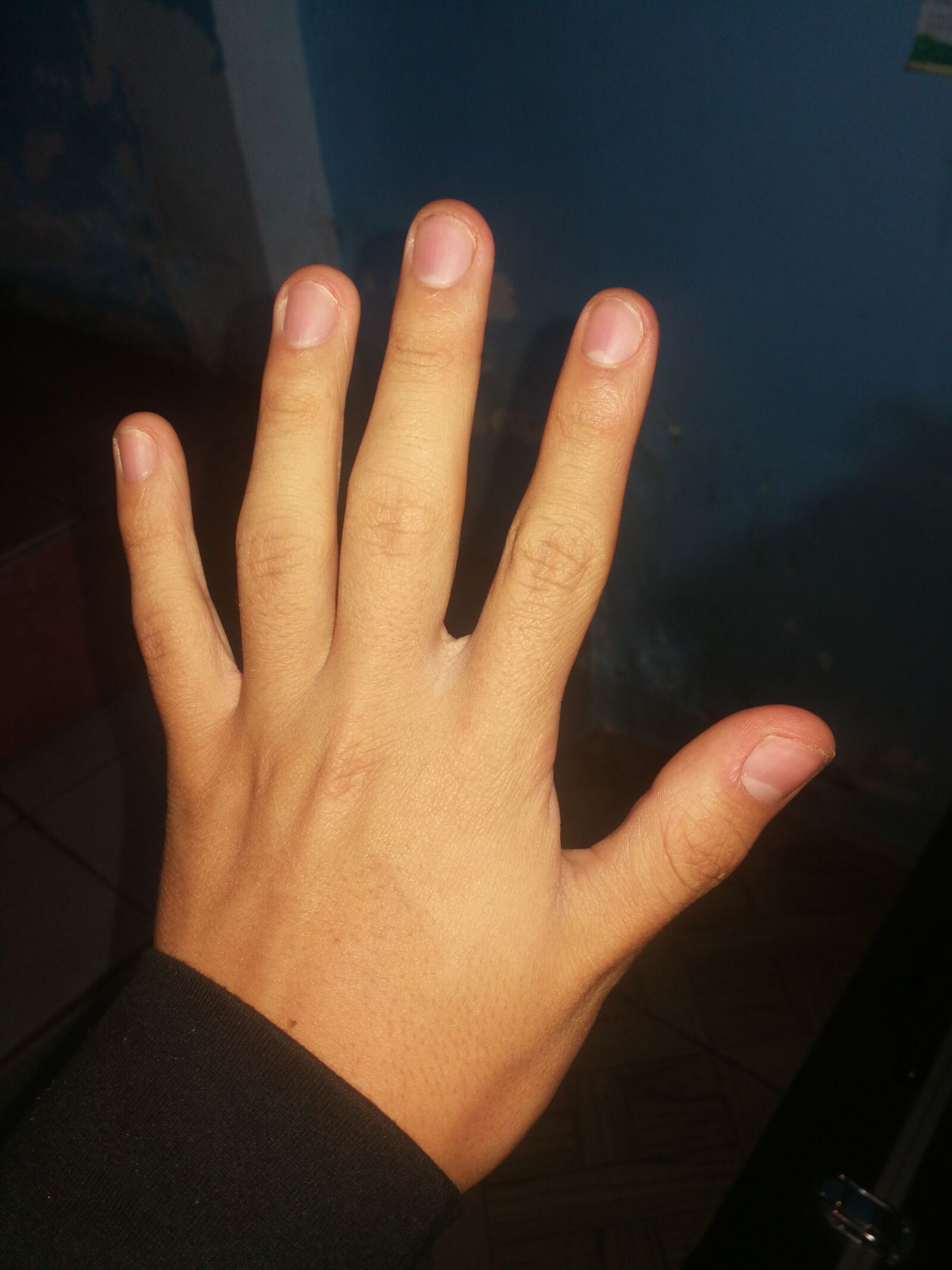 HUAWEI Mate 9 sample photo. High, nail, hand photography