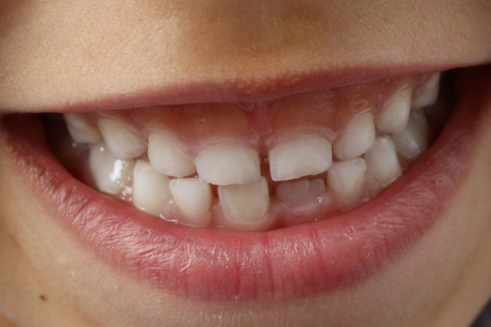 Canon EOS 7D Mark II sample photo. Teeth, child smile, child photography
