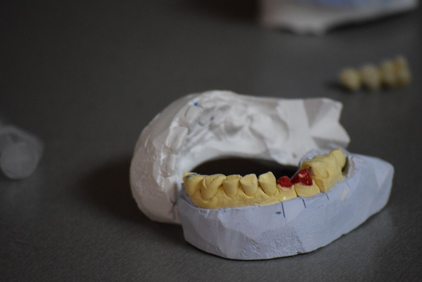 Nikon D3300 sample photo. Teeth, tooth, dental photography