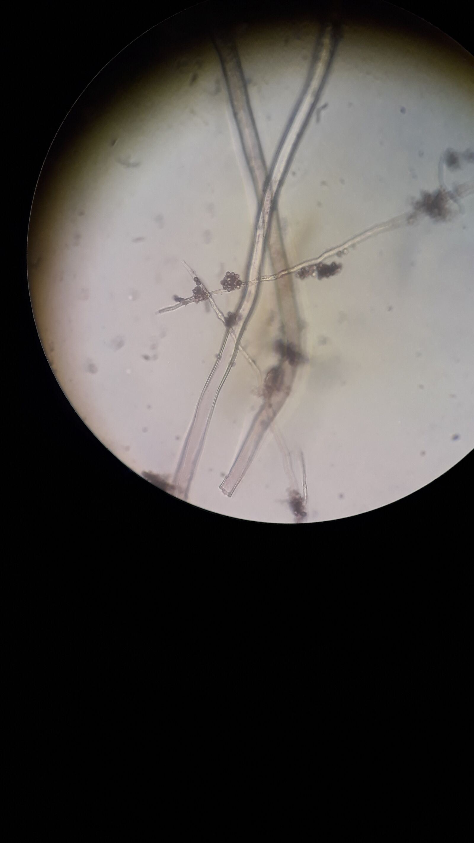 Samsung Galaxy J5 Prime sample photo. Parasitos, microscopio, nature photography