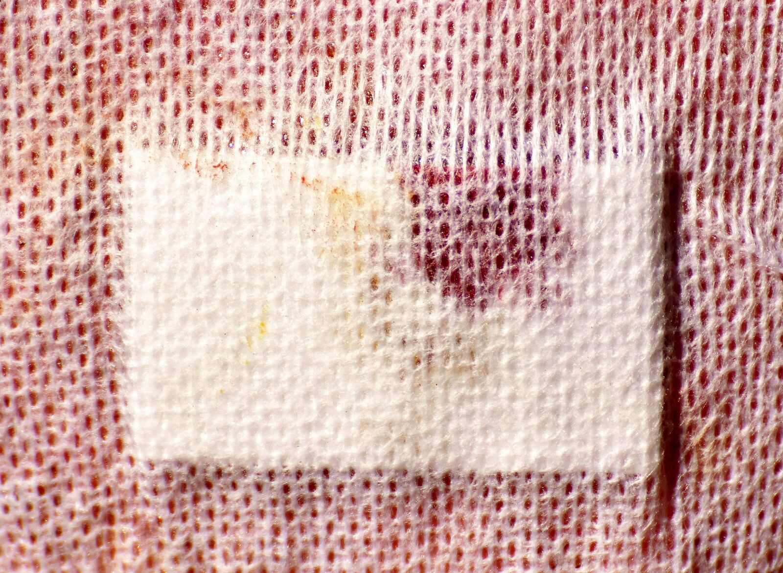 Nikon D7200 sample photo. Patch, injury, blood photography