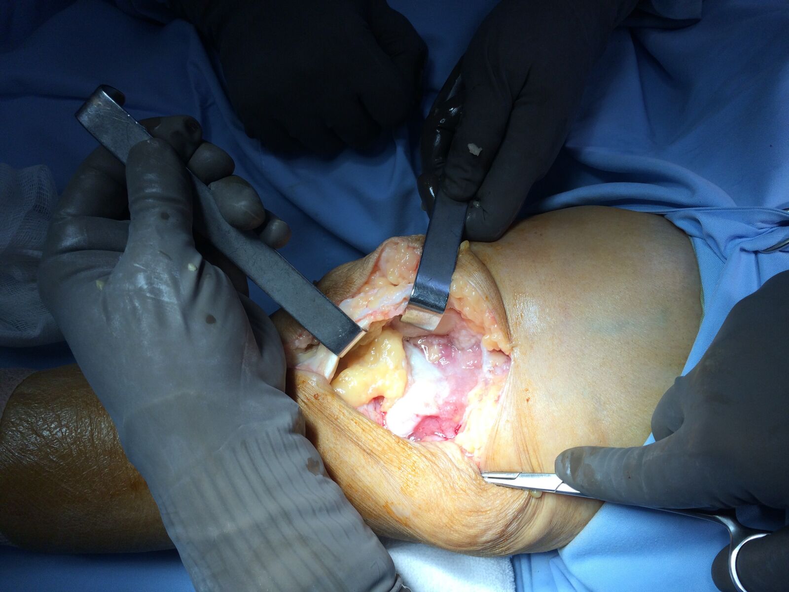 Apple iPhone 5s sample photo. Surgery, surgeon, treatment photography