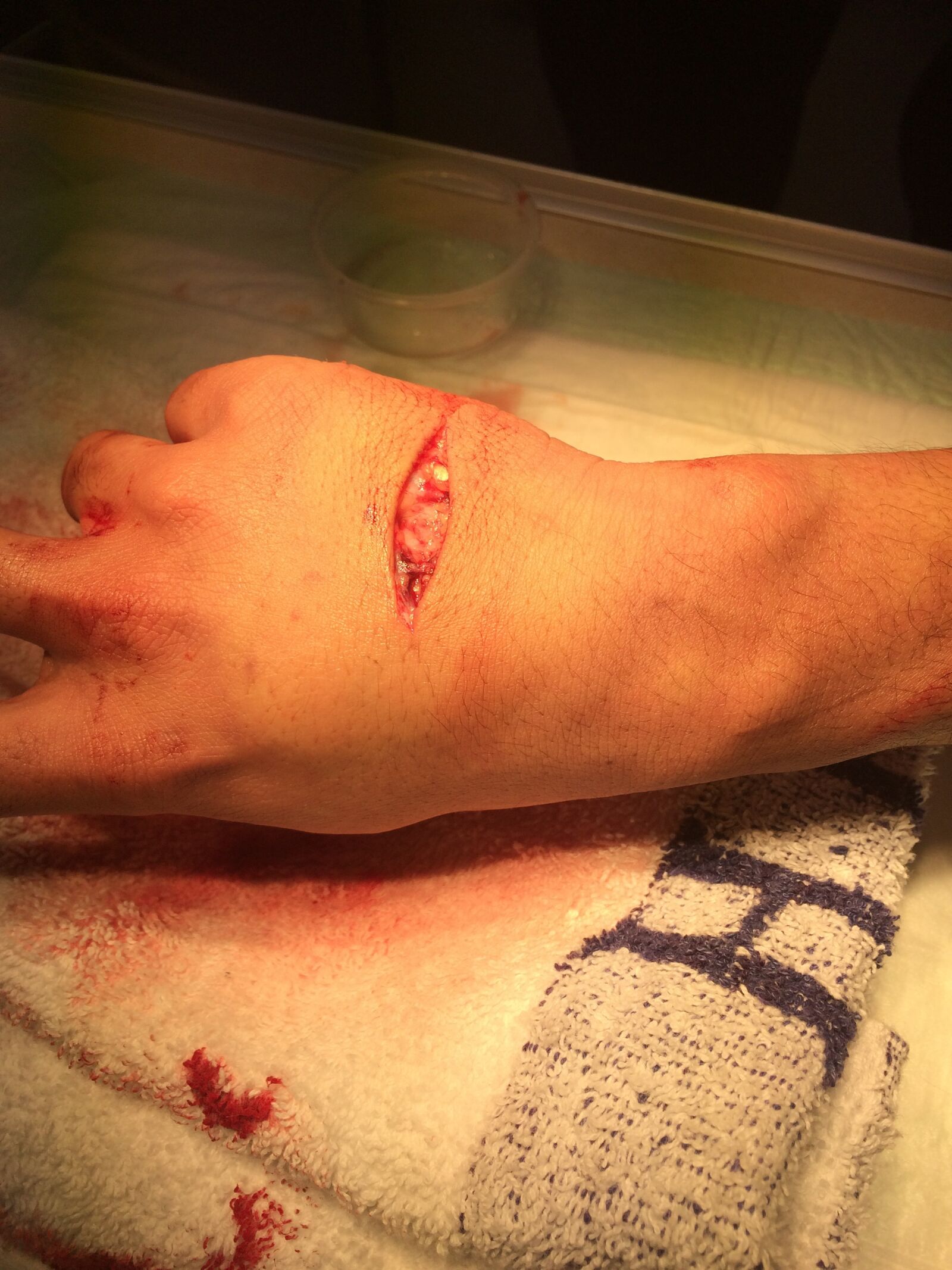 iPhone 5s back camera 4.15mm f/2.2 sample photo. Wound, injury, ice skating photography