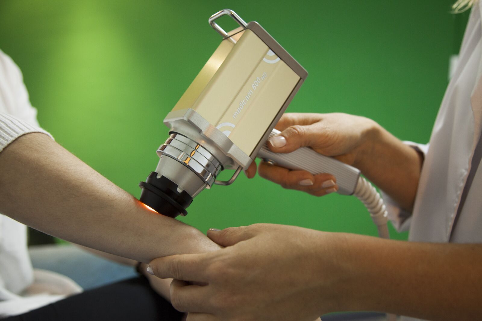 Canon EOS 5D Mark II sample photo. Treatment of skin, medicine photography