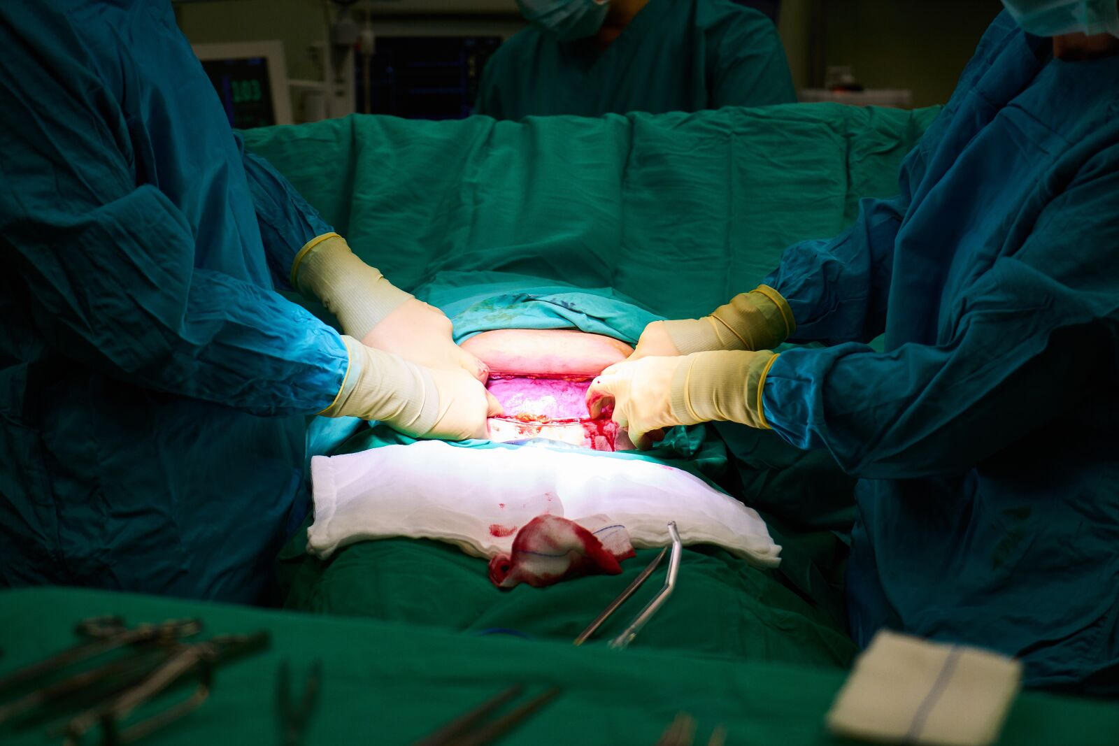 Sony a7R II sample photo. Surgery, hospital, doctor photography