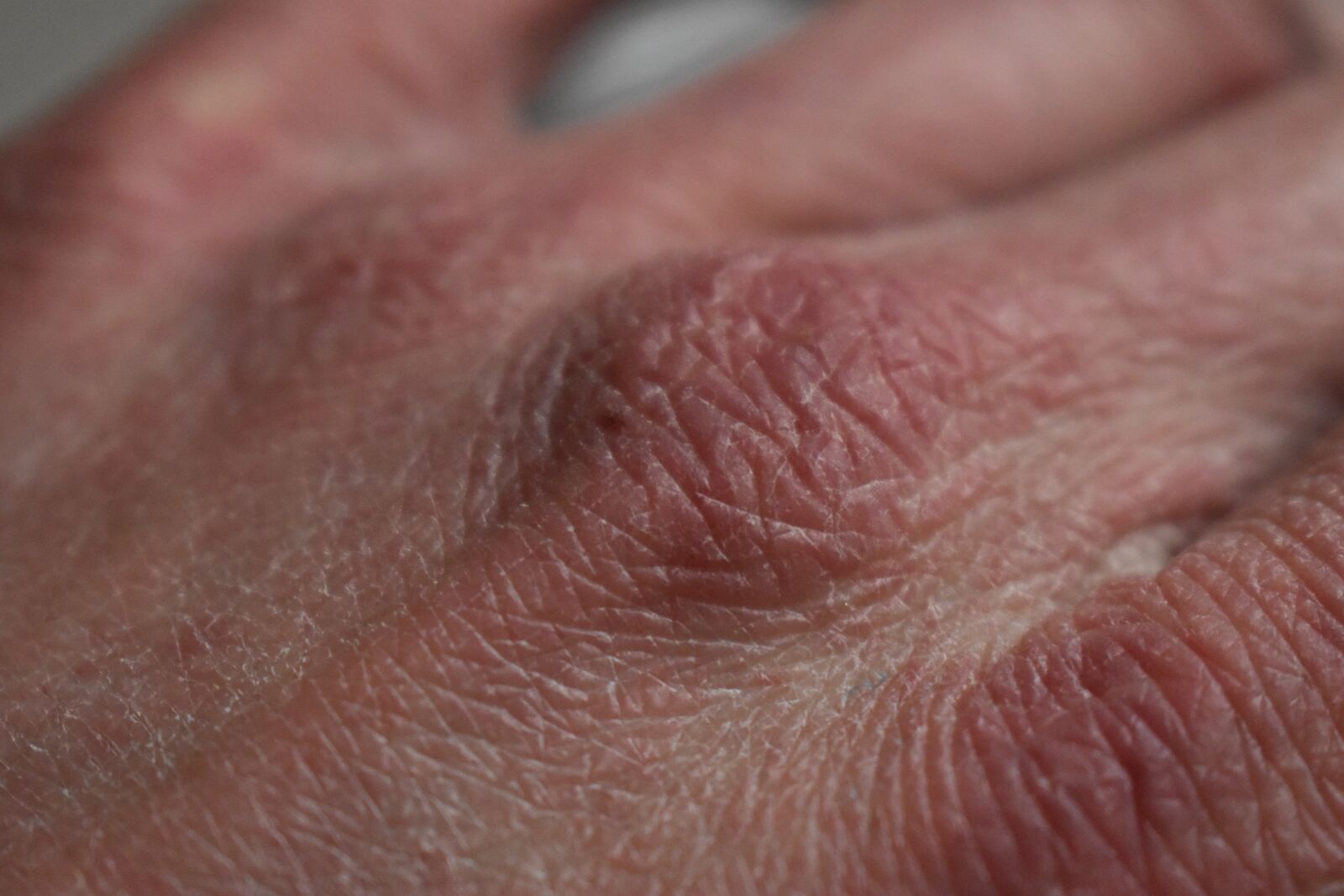 Nikon D3500 sample photo. Dry, skin, hands photography