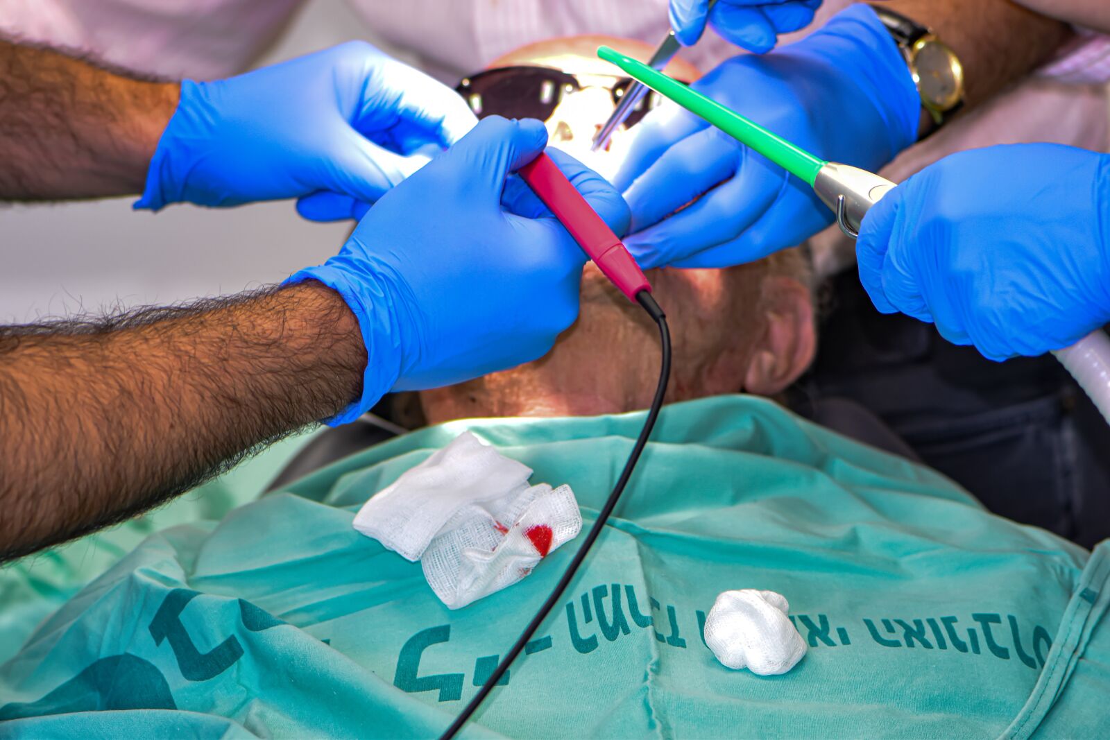 Nikon D5600 sample photo. Suction, blood, electrosurgery photography