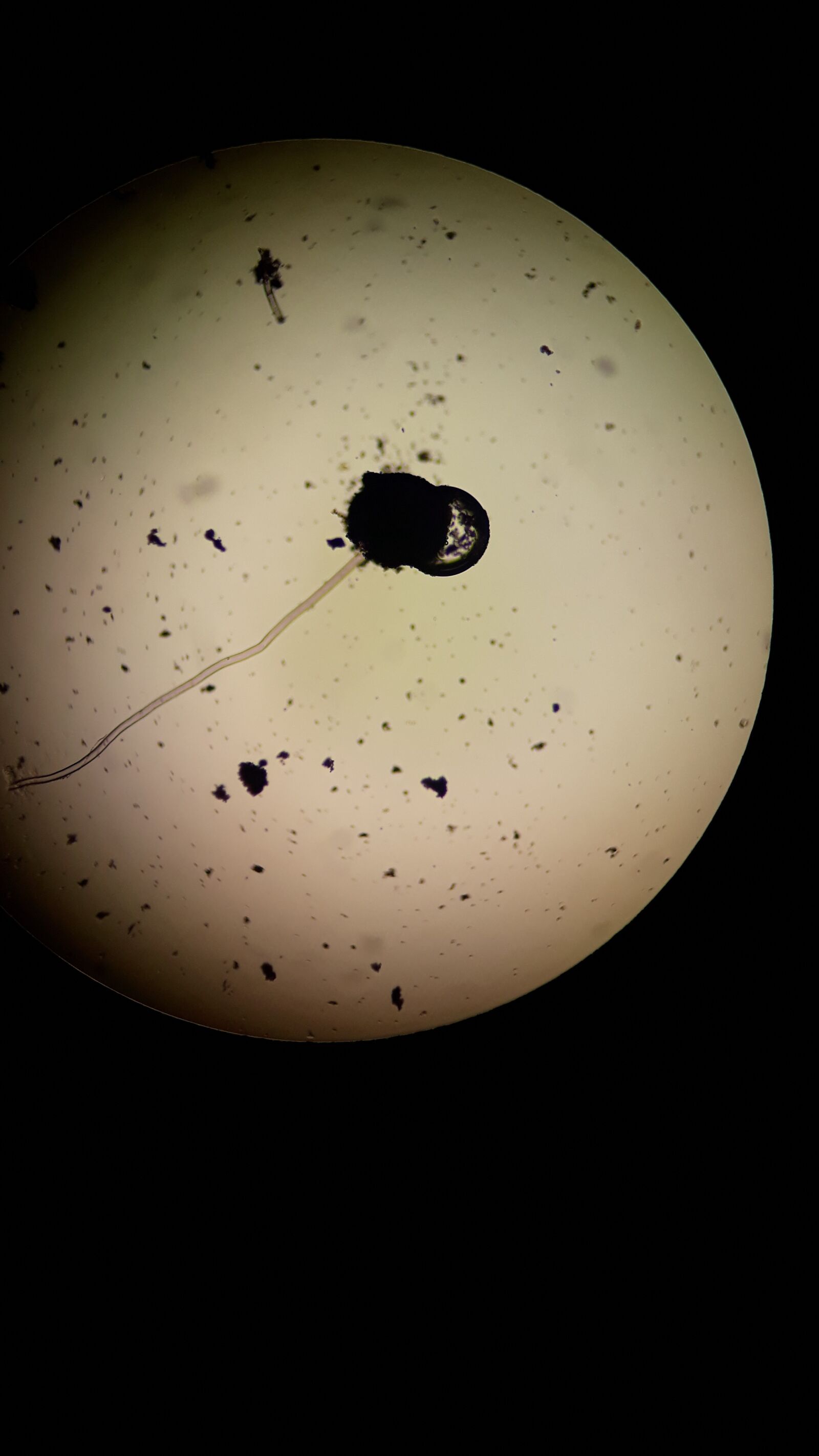 Samsung Galaxy J5 Prime sample photo. Parasitos, intestinales, microscopio photography