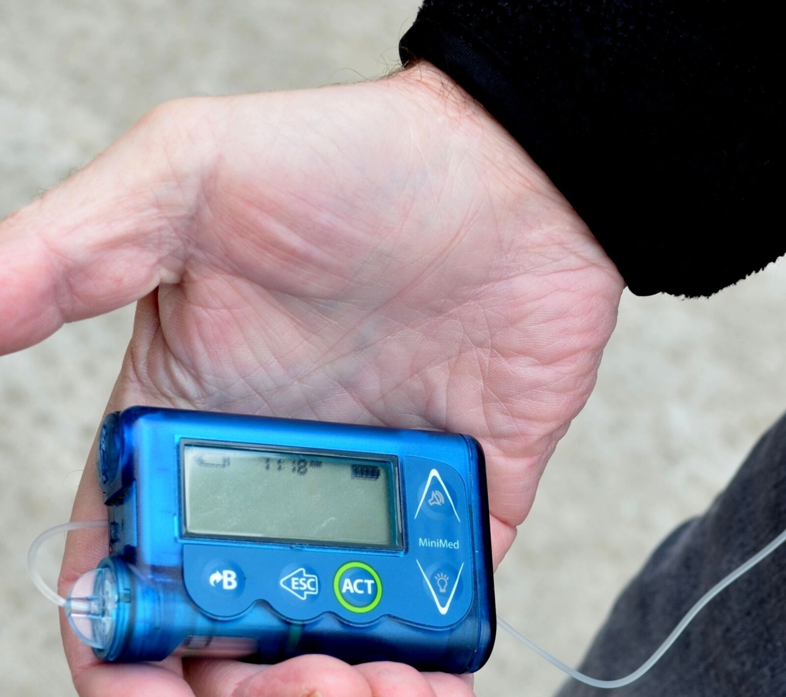 Nikon D5100 sample photo. Diabetes, insulin, pump photography