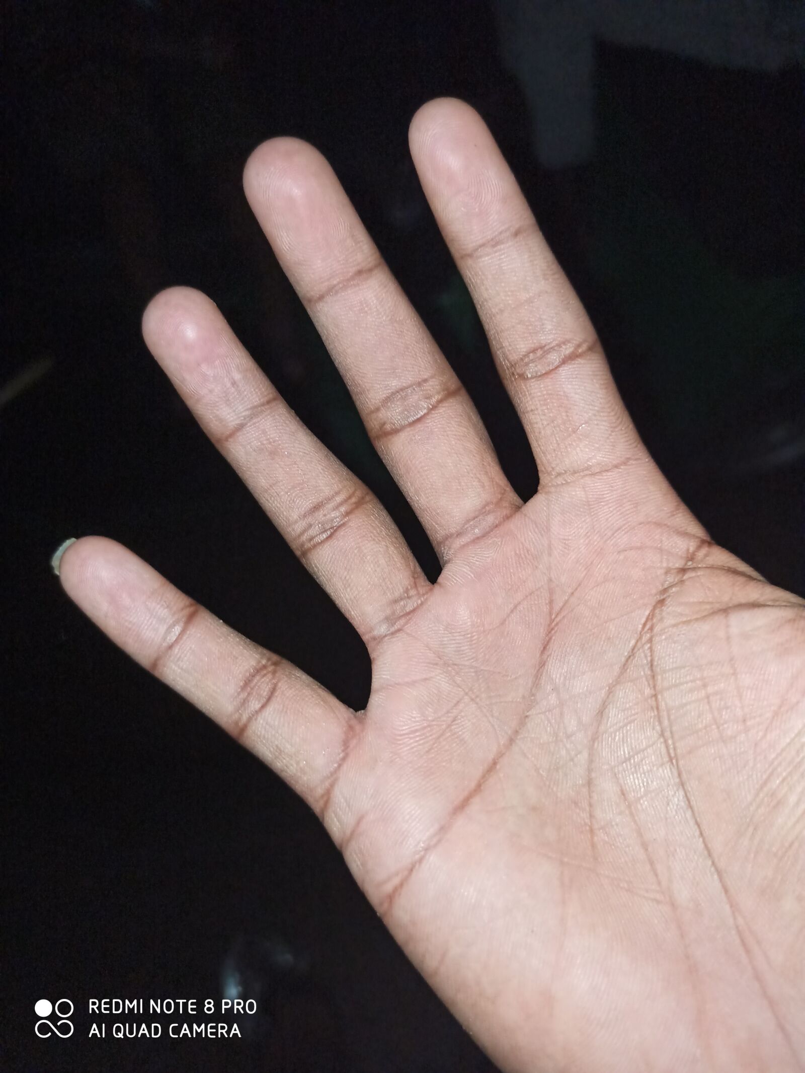 Xiaomi Redmi Note 8 Pro sample photo. Hand, finger, five finger photography