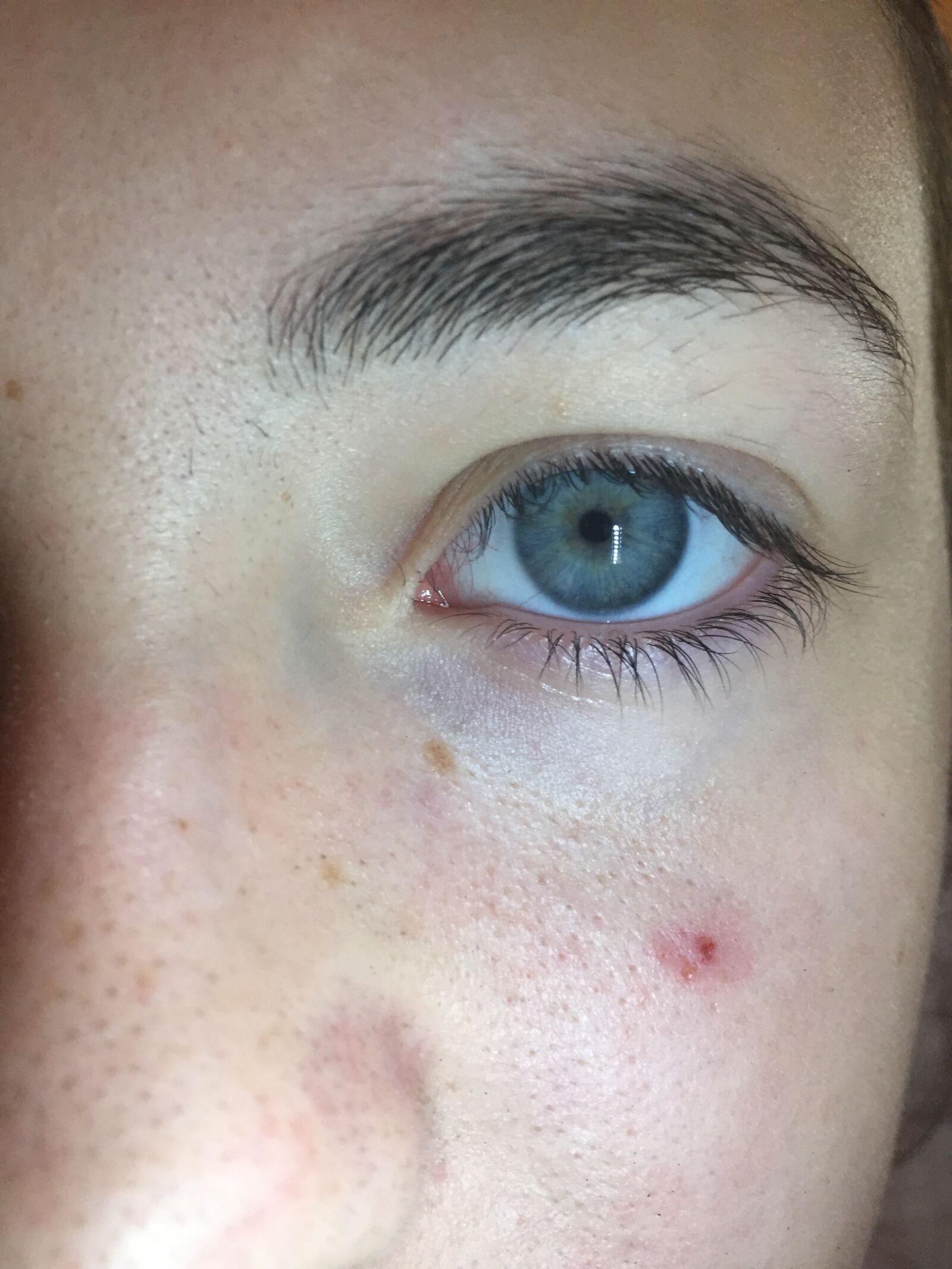 iPhone 6 back camera 4.15mm f/2.2 sample photo. Eye, blue, sadness photography