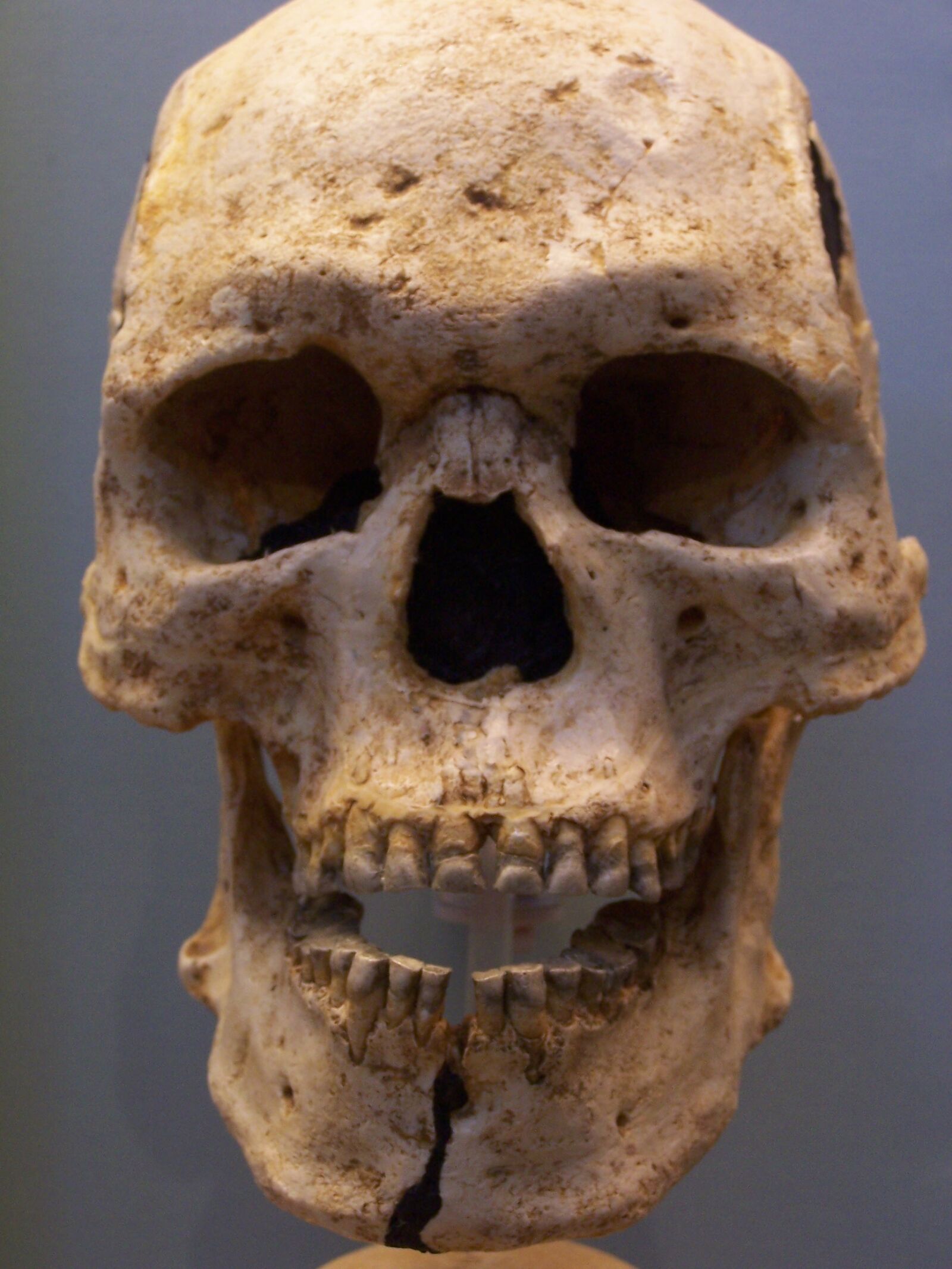 Kodak DX6490 ZOOM DIGITAL CAMERA sample photo. Real, human, skull, skull photography