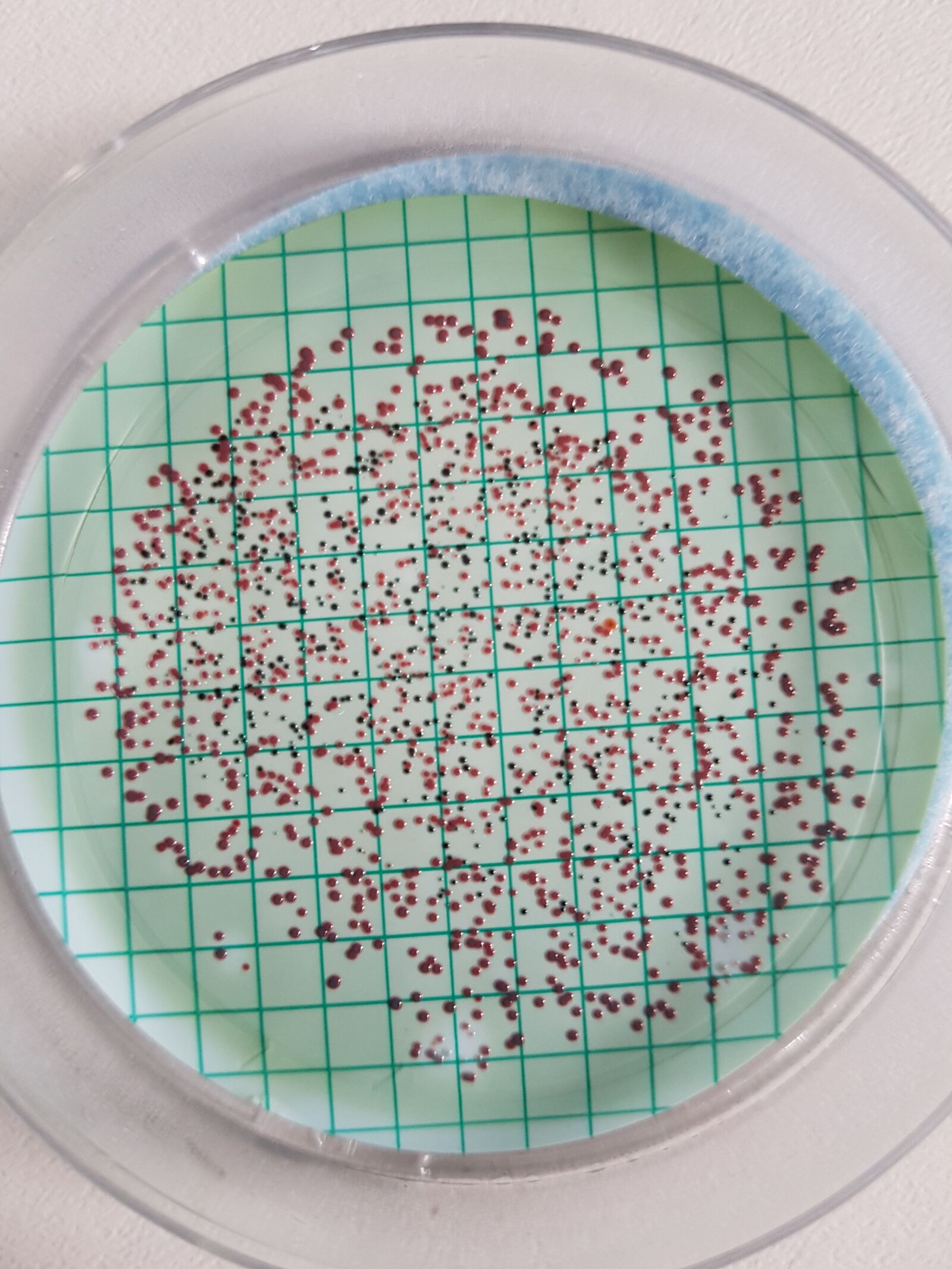 Samsung Galaxy S7 sample photo. Microbiology, bacteriology, water microbiology photography
