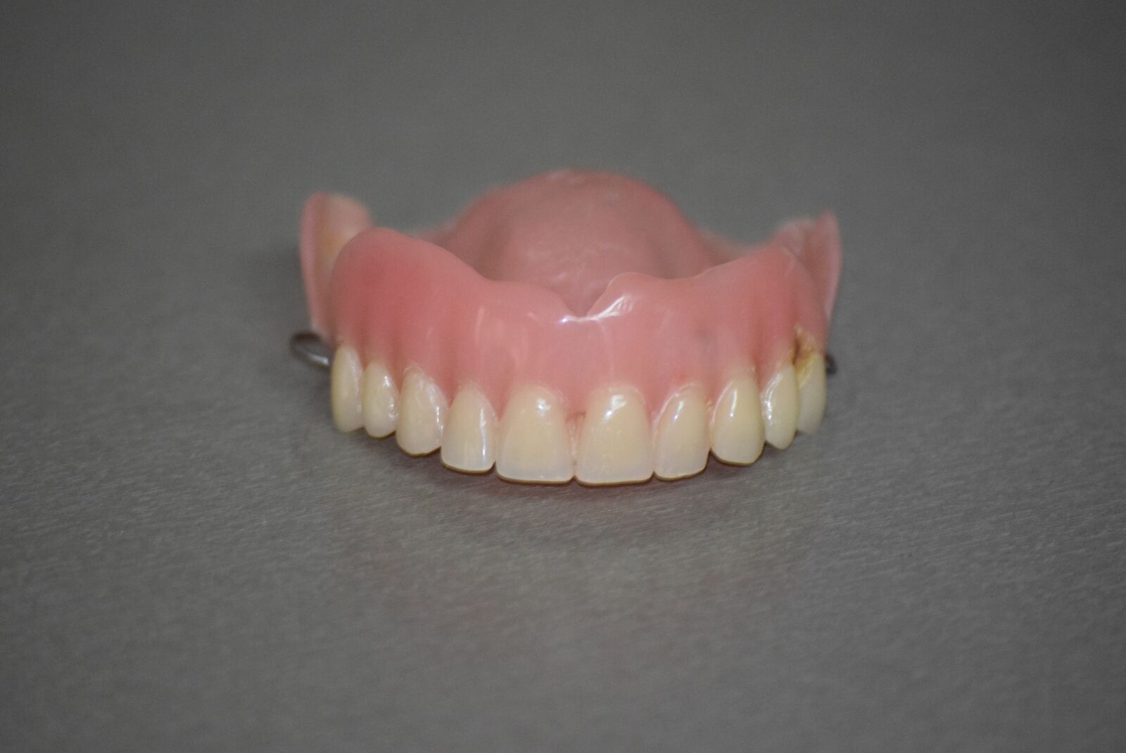 Nikon D3300 sample photo. Teeth, tooth, dental photography